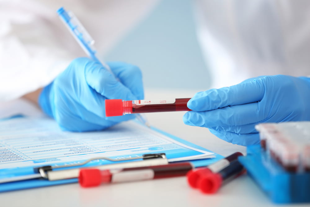 Blood test could predict most effective breast cancer treatment